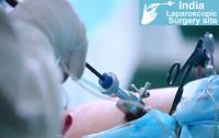 India Laparoscopy Surgery Site Consultants image 1